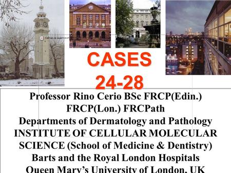 Professor Rino Cerio BSc FRCP(Edin.) FRCP(Lon.) FRCPath Departments of Dermatology and Pathology INSTITUTE OF CELLULAR MOLECULAR SCIENCE (School of Medicine.