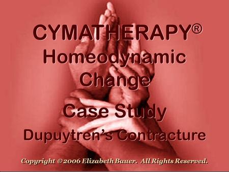 CYMATHERAPY ® Homeodynamic Change Case Study Dupuytren’s Contracture Case Study Dupuytren’s Contracture Copyright  2006 Elizabeth Bauer. All Rights Reserved.