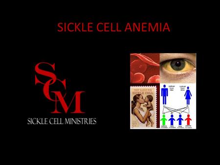 SICKLE CELL ANEMIA.