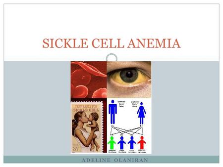 SICKLE CELL ANEMIA Adeline Olaniran.