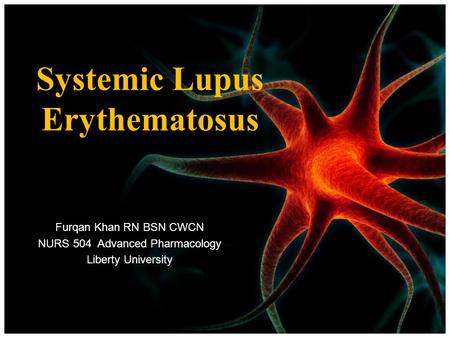 Systemic Lupus Erythematosus