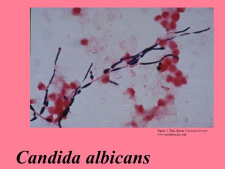 Medical mycology is a growing field of interest because an increased number of clinical diseases are associated with pathogenic fungi. From athlete’s.