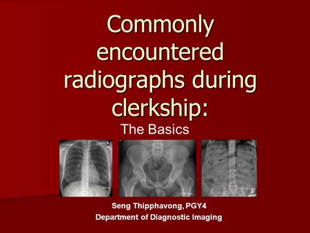 Commonly encountered radiographs during clerkship: The Basics Seng Thipphavong, PGY4 Department of Diagnostic Imaging.