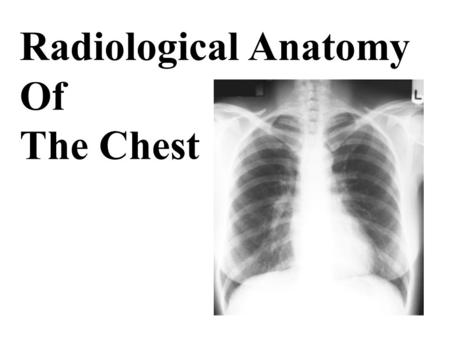 Radiological Anatomy Of The Chest