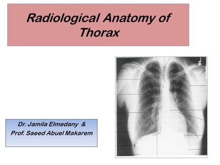 Radiological Anatomy of Thorax