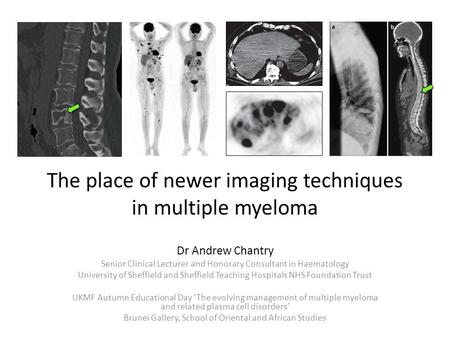 The place of newer imaging techniques in multiple myeloma