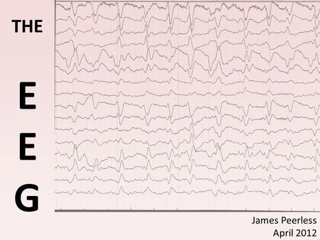 THE EEGEEG James Peerless April 2012. Objectives Physics and Clinical Measurement Anaesthesia for neurosurgery, neuroradiology and neurocritical care.