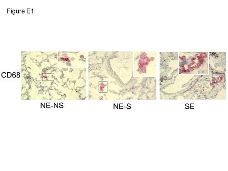 CD68 NE-SSE NE-NS Figure E1. Nrf2 42-kD  actin 32-kD HO-1 100-kD Control si RNA si RNA Nrf2 Control si RNA si RNA Nrf2 Control si RNA si RNA Nrf2 Control.