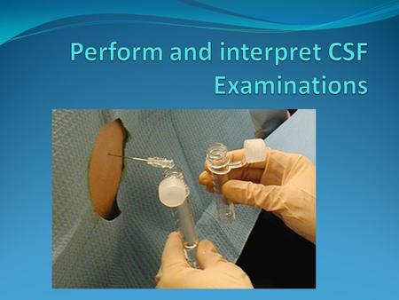 CSF The cerebrospinal fluid is a colourless fluid that, as the name indicates, can be found around and inside the brain and spinal cord in the subarachnoid.