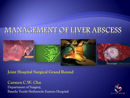 Joint Hospital Surgical Grand Round Carmen C.W. Chu Department of Surgery, Pamela Youde Nethersole Eastern Hospital.