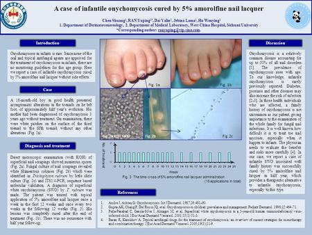 Fig. 2c A case of infantile onychomycosis cured by 5% amorolfine nail lacquer Chen Shuang 1, RAN Yuping 1*, Dai Yalin 2, Jebina Lama 1, Hu Wenying 1 1.