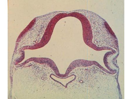 EYE AND EAR: 01 HUMAN FOREBRAIN (CROSS SECTION): This is a cross section through the forebrain of a human embryo. Identify the DIENCEPHALON, OPTIC STALK,