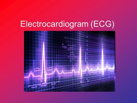 Electrocardiogram (ECG)