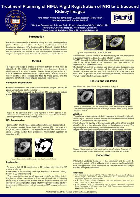 Treatment Planning of HIFU: Rigid Registration of MRI to Ultrasound Kidney Images Tara Yates 1, Penny Probert Smith 1, J. Alison Noble 1, Tom Leslie 2,