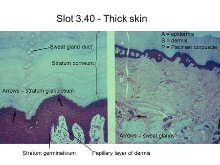 Slot 3.40 - Thick skin A = epidermis B = dermis P = Pacinian corpuscle Arrows = sweat glands Papillary layer of dermis Stratum corneum Sweat gland duct.