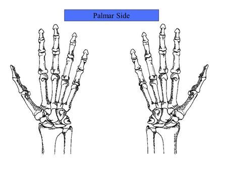 Palmar Side. Name this bone Trapezium Name this bone.