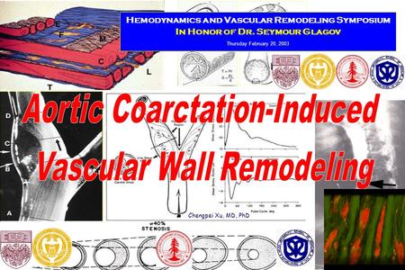 Chengpei Xu, MD, PhD Hemodynamics and Vascular Remodeling Symposium In Honor of Dr. Seymour Glagov Thursday February 20, 2003.