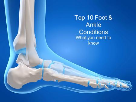 Top 10 Foot & Ankle Conditions What you need to know.