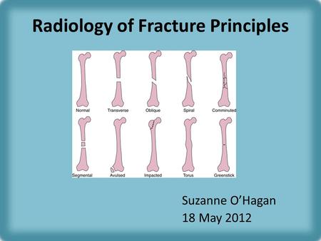 Radiology of Fracture Principles