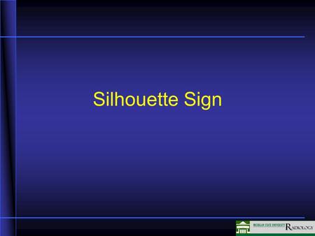 Silhouette Sign. Frontal X-ray Signs of Lobar Consolidation RUL – loss of upper right mediastinal border RML – loss of right heart border RLL – loss of.