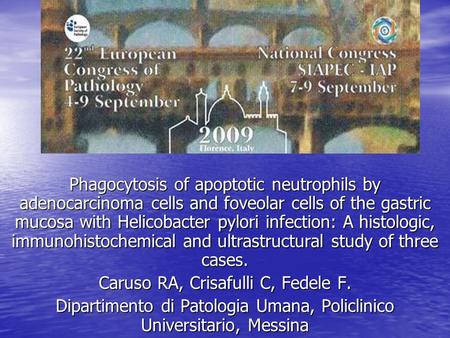 Phagocytosis of apoptotic neutrophils by adenocarcinoma cells and foveolar cells of the gastric mucosa with Helicobacter pylori infection: A histologic,