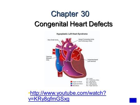 Congenital Heart Defects