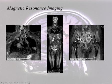 Magnetic Resonance Imaging