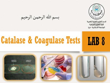  In the microbiology lab, biochemical test relays on enzymes which is glycoprotein or protein that act as catalyst by lowering the activation energy.