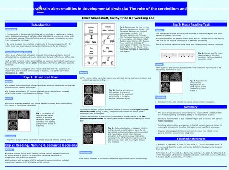 Introduction Impairments in development dyslexia are not confined to reading and literacy skills. Additional behavioural deficits include phonological.