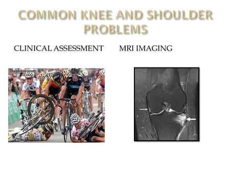 CLINICAL ASSESSMENTMRI IMAGING. PANACEA ?PANDORA’S BOX ?