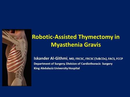 Robotic-Assisted Thymectomy in Myasthenia Gravis Iskander Al-Githmi, MD, FRCSC, FRCSC (Ts&CDs), FACS, FCCP Department of Surgery. Division of Cardiothoracic.