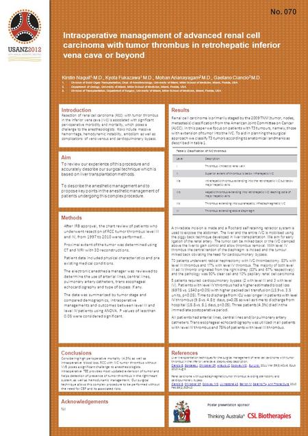 Intraoperative management of advanced renal cell carcinoma with tumor thrombus in retrohepatic inferior vena cava or beyond Introduction Resection of renal.