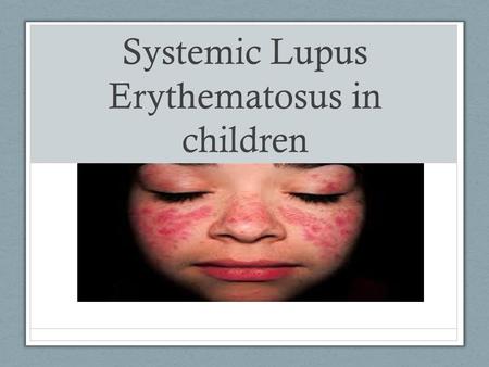 Systemic Lupus Erythematosus in children. Objectives Student will be able to define Lupus Student will be able list at least 3 clinical manifestation.