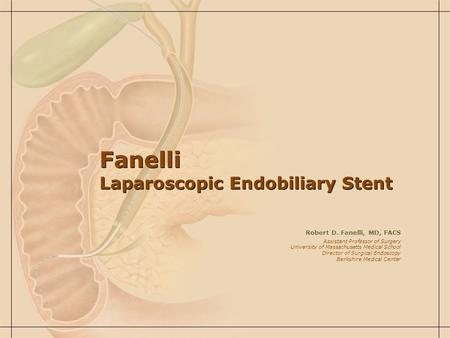 Fanelli Laparoscopic Endobiliary Stent