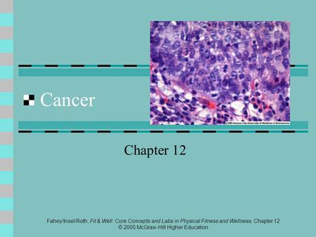 Fahey/Insel/Roth, Fit & Well: Core Concepts and Labs in Physical Fitness and Wellness, Chapter 12 © 2005 McGraw-Hill Higher Education Cancer Chapter 12.