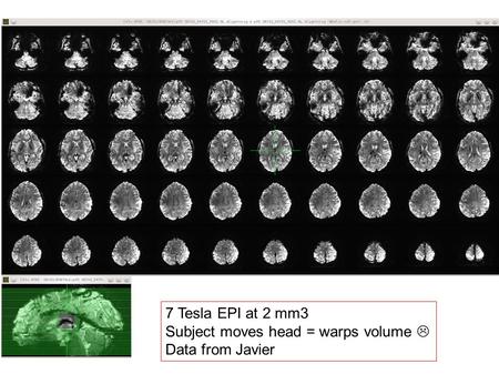 7 Tesla EPI at 2 mm3 Subject moves head = warps volume  Data from Javier.