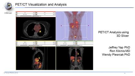 -- CTSA at RSNA 2010 PET/CT Analysis using 3D Slicer Jeffrey Yap PhD Ron Kikinis MD Wendy Plesniak PhD PET/CT Visualization and Analysis.