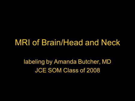 MRI of Brain/Head and Neck