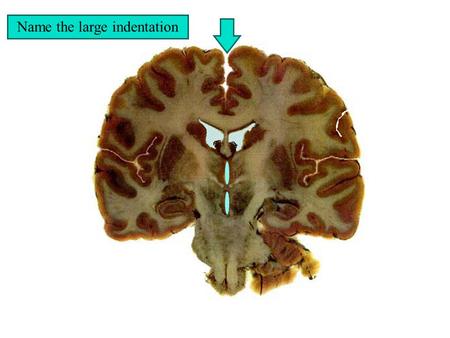 Name the large indentation