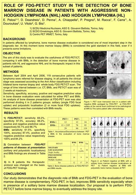 ROLE OF FDG-PET/CT STUDY IN THE DETECTION OF BONE MARROW DISEASE IN PATIENTS WITH AGGRESSIVE NON- HODGKIN LYMPHOMA (NHL) AND HODGKIN LYMPHOMA (HL) Figure.