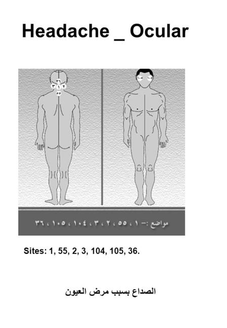 Headache _ Ocular Sites: 1, 55, 2, 3, 104, 105, 36. الصداع بسبب مرض العيون.