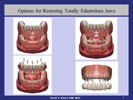 Gerald A. Niznick DMD, MSD 1 Options for Restoring Totally Edentulous Jaws.