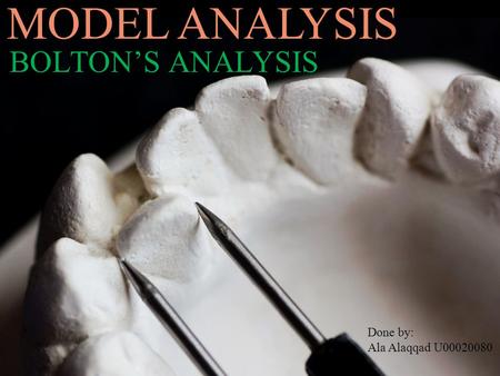 MODEL ANALYSIS BOLTON’S ANALYSIS Done by: Ala Alaqqad U00020080.