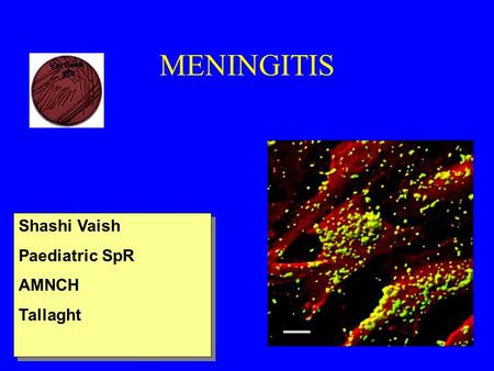 MENINGITIS Shashi Vaish Paediatric SpR AMNCH Tallaght Con Samaan