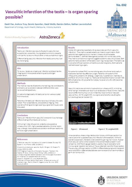 Vasculitic Infarction of the testis – Is organ sparing possible? Introduction Testicular infarction as a result of systemic vasculitis is an exceptionally.