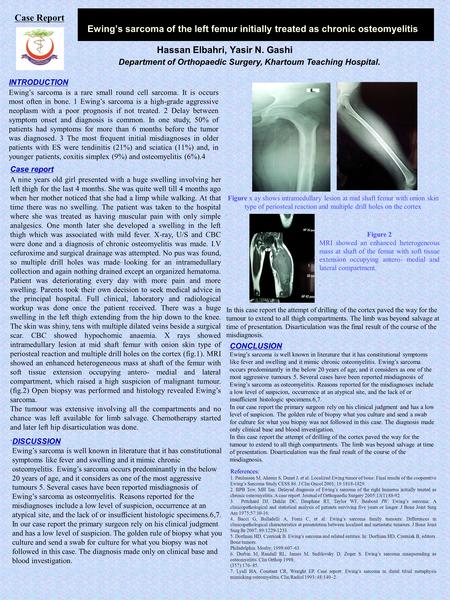 Ewing’s sarcoma of the left femur initially treated as chronic osteomyelitis Hassan Elbahri, Yasir N. Gashi INTRODUCTION Ewing’s sarcoma is a rare small.