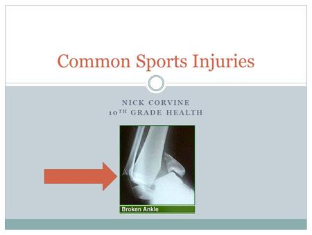 Common Sports Injuries