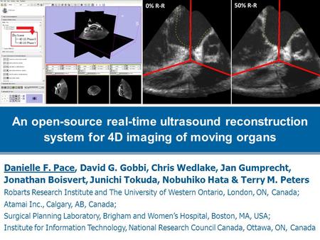 Danielle F. Pace, David G. Gobbi, Chris Wedlake, Jan Gumprecht, Jonathan Boisvert, Junichi Tokuda, Nobuhiko Hata & Terry M. Peters Robarts Research Institute.