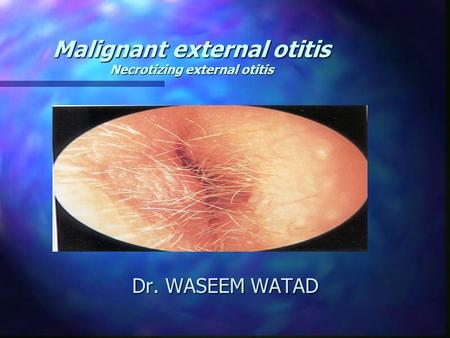 Malignant external otitis Necrotizing external otitis