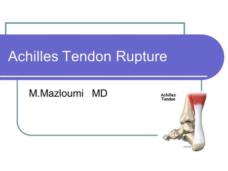 Achilles Tendon Rupture M.Mazloumi MD. Anatomy Largest tendon in the body Origin from gastrocnemius and soleus muscles Insertion on calcaneal tuberosity.